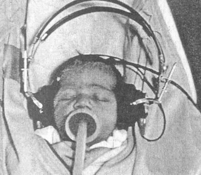 Рис. 3.2. Звукові переваги. Перевагу певних звуків - наприклад, голоси матері - може проявлятися у новонародженого в більш енергійному ссанні, якщо останнє викликає відтворення заданих звуків у навушниках.